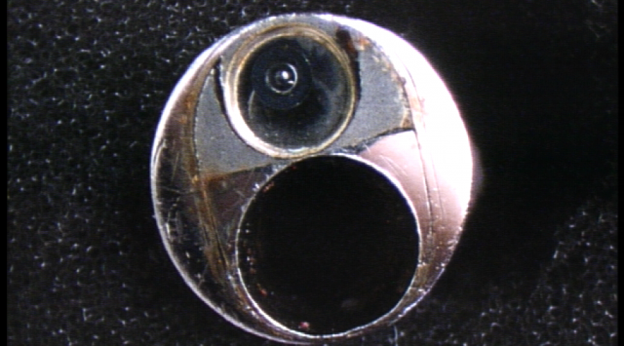 經(jīng)皮腎鏡碎石取石術的教學模塊及SOPRO 165800011經(jīng)皮腎鏡的維修案例分析